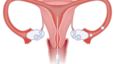 asilama nedir tedavi asamalari nelerdir