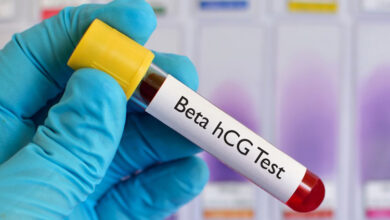 beta hcg nedir degeri kac olmali