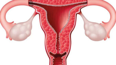 hidrosalpinks nedir belirtileri ve tedavi yontemleri