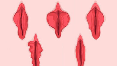 labioplasti ameliyati 2