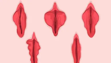 labioplasti ameliyati 2