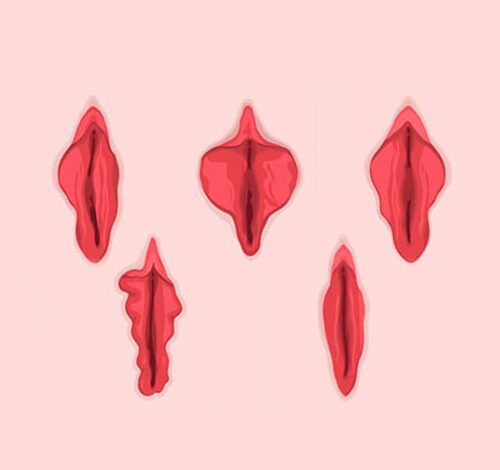 labioplasti ameliyati 2
