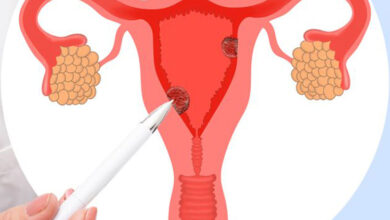 rahim agzi yarasi servikal erozyon