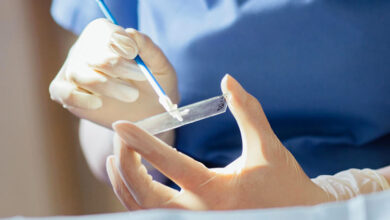 smear testi nedir neden ve nasil yapilir