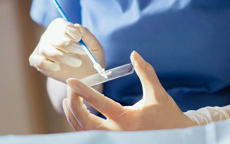 smear testi nedir neden ve nasil yapilir
