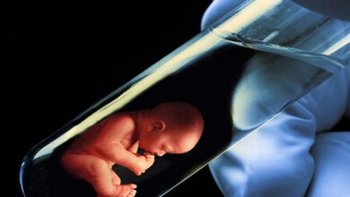 tup bebek tedavisi oncesi dikkat edilmesi gerekenler