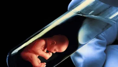 tup bebek tedavisi oncesi dikkat edilmesi gerekenler