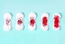 adet sonrası lekelenme