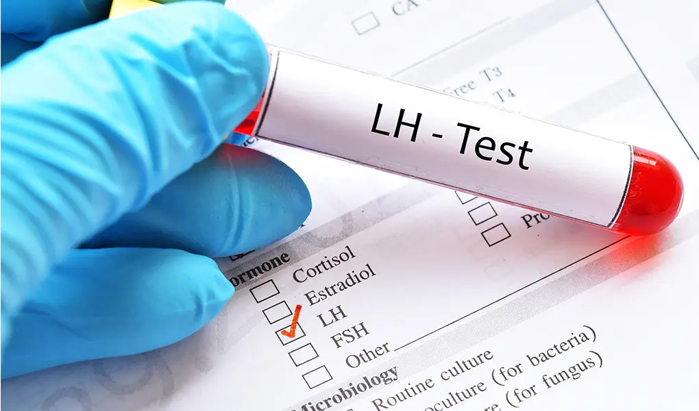 LH Testi