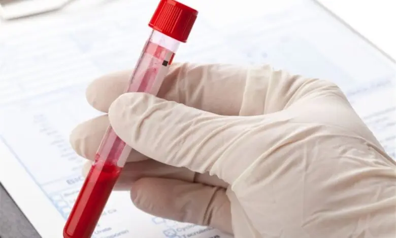Estradiol Nedir?