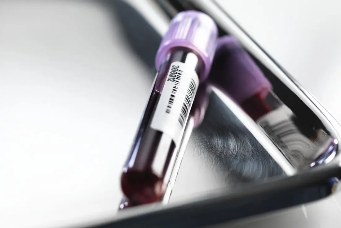Estradiol Test
