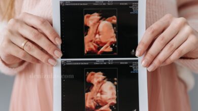 4 boyutlu ultrason nasil yapilir